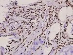 TBX15/TBX18 Polyclonal Antibody