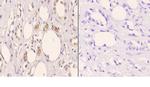 TOP3B Polyclonal Antibody
