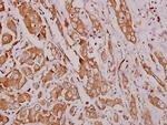 HEXB Polyclonal Antibody