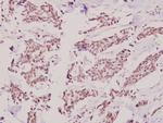 HKR1 Polyclonal Antibody