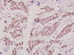 HKR1 Antibody in Immunohistochemistry (Paraffin) (IHC (P))