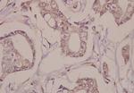 Fra1 Polyclonal Antibody