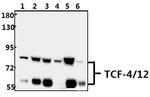 TCF4/TCF12 Polyclonal Antibody