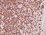 CLK2 Antibody in Immunohistochemistry (Paraffin) (IHC (P))