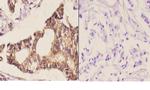 MEK6 Polyclonal Antibody