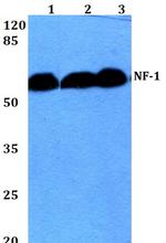 NFI Antibody in Western Blot (WB)