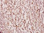 TUSC3 Antibody in Immunohistochemistry (Paraffin) (IHC (P))