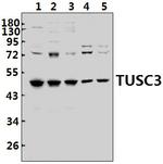 TUSC3 Antibody in Western Blot (WB)