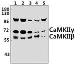 CaMKII beta/gamma Polyclonal Antibody