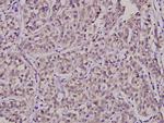 SURF1 Polyclonal Antibody
