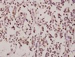 ZNF174 Antibody in Immunohistochemistry (Paraffin) (IHC (P))