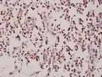 ZNF174 Polyclonal Antibody
