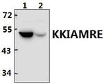 CDKL2 Antibody in Western Blot (WB)