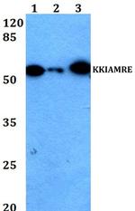 CDKL2 Antibody in Western Blot (WB)