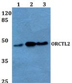 SLC22A18 Polyclonal Antibody