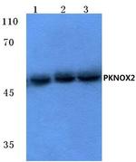 PKNOX2 Antibody in Western Blot (WB)