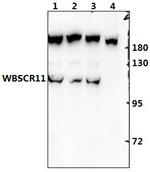 GTF2IRD1 Polyclonal Antibody