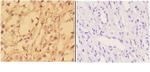 alpha Actinin 3 Polyclonal Antibody
