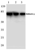 gamma Adducin Antibody in Western Blot (WB)