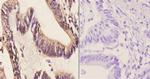 CABLES1 Antibody in Immunohistochemistry (Paraffin) (IHC (P))