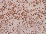 CDH18 Polyclonal Antibody