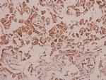 CDH18 Antibody in Immunohistochemistry (Paraffin) (IHC (P))