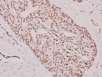 ATF3 Polyclonal Antibody