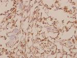 GTF2H1 Polyclonal Antibody