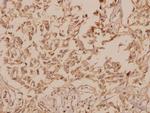 hnRNP H2 Antibody in Immunohistochemistry (Paraffin) (IHC (P))