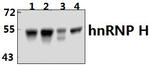 hnRNP H2 Antibody in Western Blot (WB)