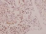 IRX1 Polyclonal Antibody