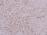 FOXK1 Polyclonal Antibody