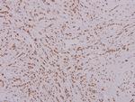 FOXK1 Antibody in Immunohistochemistry (Paraffin) (IHC (P))