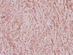 C/EBP zeta Polyclonal Antibody