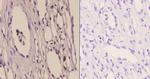 GTF2H2 Polyclonal Antibody