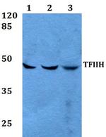 GTF2H2 Antibody in Western Blot (WB)