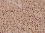 CUG-BP Polyclonal Antibody