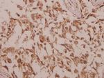 CHKB Polyclonal Antibody
