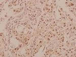 MRCK beta Antibody in Immunohistochemistry (Paraffin) (IHC (P))