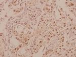 MRCK beta Polyclonal Antibody