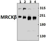 MRCK beta Antibody in Western Blot (WB)