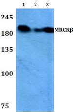 MRCK beta Antibody in Western Blot (WB)