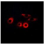 Laminin gamma-1 Polyclonal Antibody
