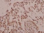 SIAH2 Polyclonal Antibody