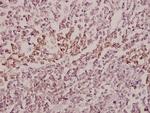 MID1 Polyclonal Antibody