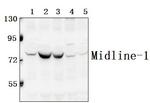 MID1 Antibody in Western Blot (WB)