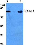 MID1 Antibody in Western Blot (WB)