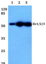 ZIC1/ZIC2/ZIC3 Antibody in Western Blot (WB)
