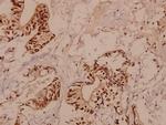 RBM5 Antibody in Immunohistochemistry (Paraffin) (IHC (P))