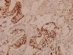 RBM5 Antibody in Immunohistochemistry (Paraffin) (IHC (P))